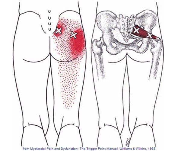 découvrez les principales causes de la sciatique à la jambe gauche, de la hernie discale aux tensions musculaires. apprenez à identifier les symptômes et explorez des solutions pour soulager cette douleur invalidante.
