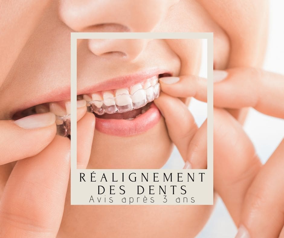 découvrez tout ce qu'il faut savoir sur les avis concernant la dentition. que ce soit pour des conseils de soins dentaires, des témoignages d'experts ou des recommandations pratiques, trouvez les informations essentielles pour maintenir une bonne santé bucco-dentaire.