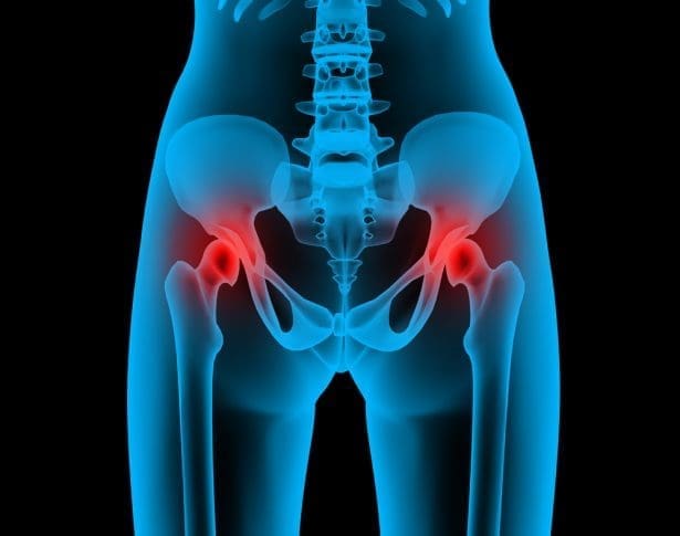 découvrez les causes, symptômes et traitements pour soulager la douleur à la hanche gauche. informez-vous sur les meilleures pratiques pour améliorer votre confort et votre mobilité.