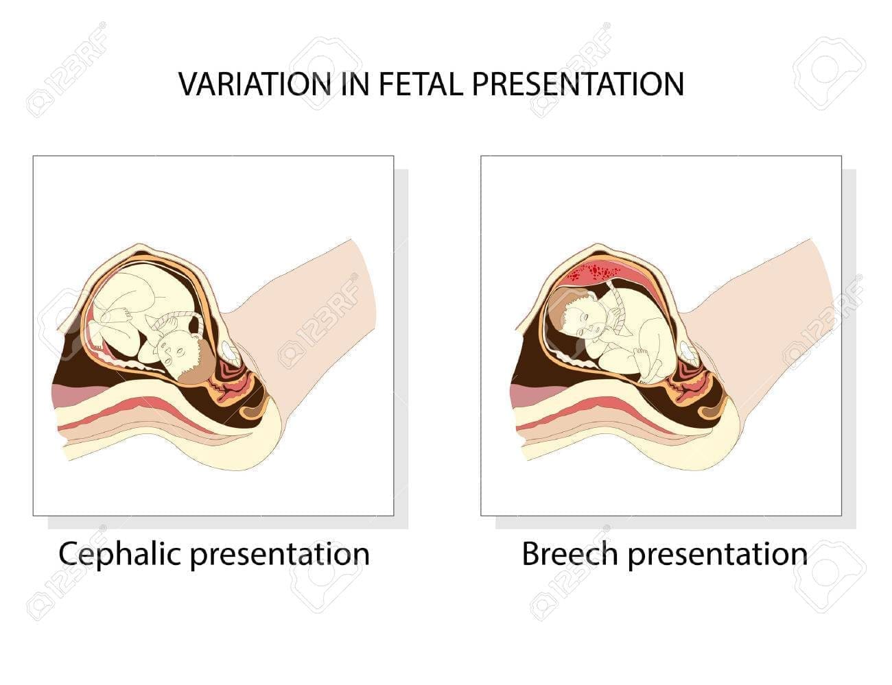 découvrez la zone céphalique, une région anatomique essentielle qui englobe la tête et le cou. explorez son rôle crucial dans le système nerveux, l'appareil sensoriel et ses interactions avec le reste du corps. informez-vous sur les pathologies possibles et les soins nécessaires pour préserver cette zone clé de notre santé.