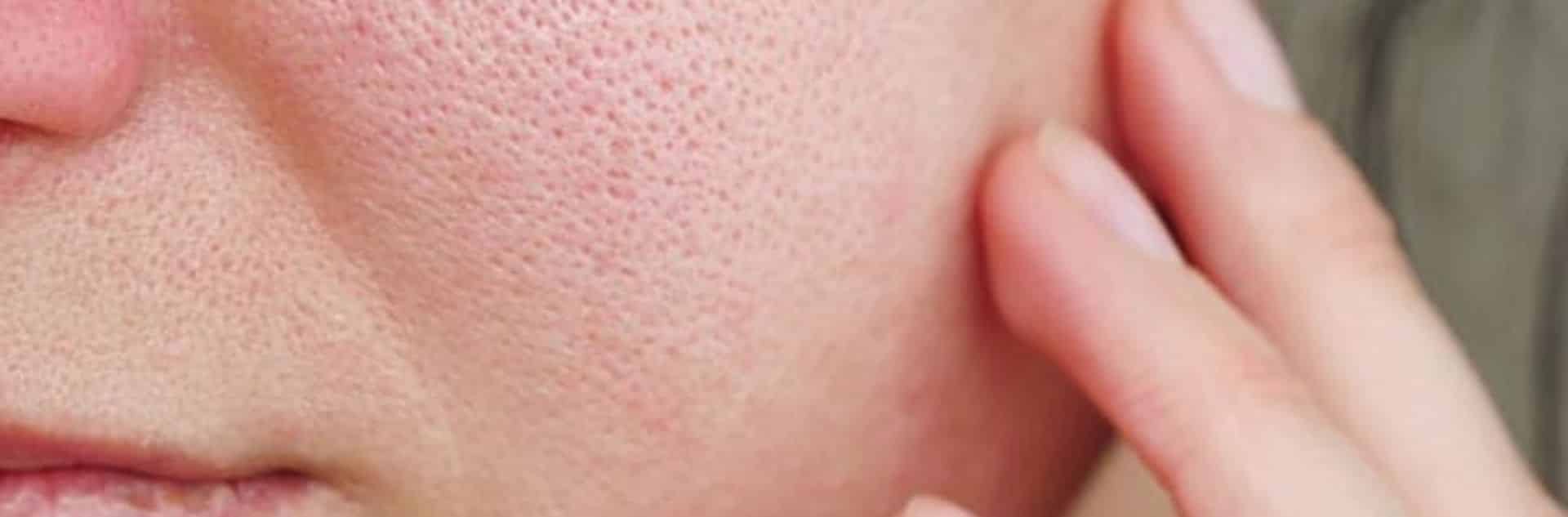 découvrez des conseils et des astuces pour ralentir le vieillissement de votre peau et de votre corps. apprenez à adopter un mode de vie sain, à choisir des produits anti-âge efficaces et à intégrer des routines de soins qui préservent votre jeunesse. ne laissez pas le temps vous rattraper !