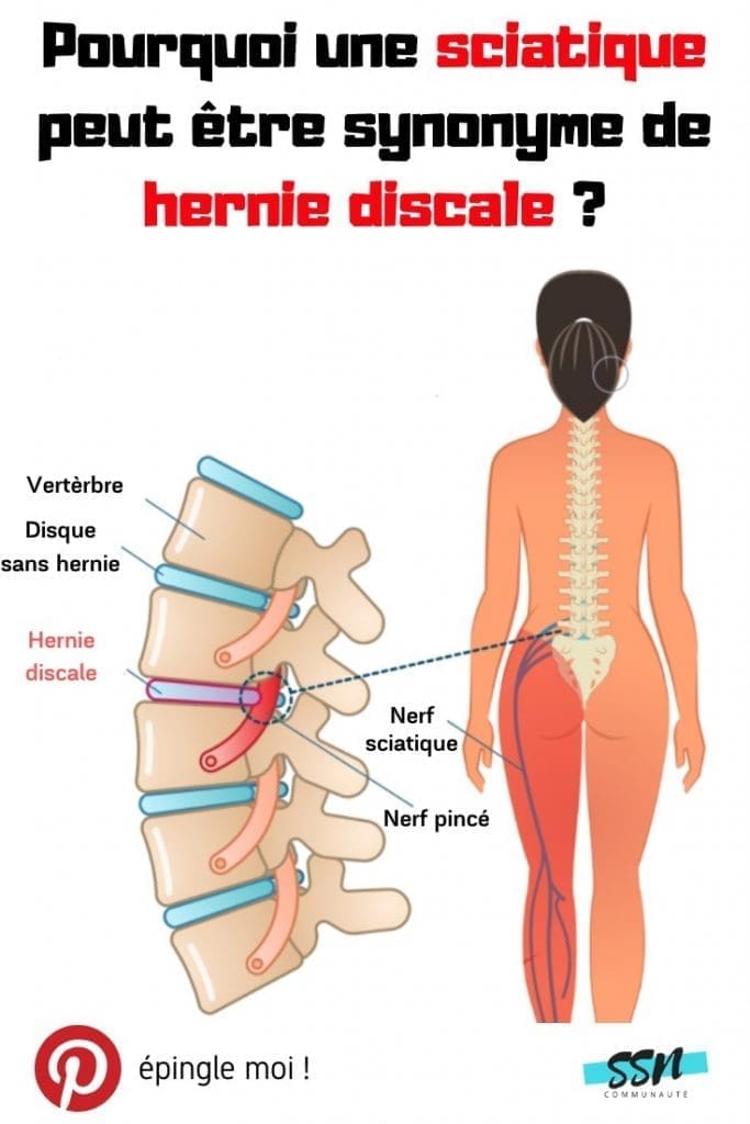 découvrez les causes de la sciatique gauche dans notre article détaillé. apprenez à identifier les facteurs responsables de cette douleur et à mieux comprendre vos symptômes pour un soulagement efficace.