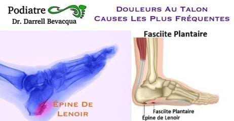 découvrez les causes, symptômes et traitements de la douleur au talon gauche. informez-vous sur les solutions efficaces pour soulager votre gêne et améliorer votre qualité de vie.