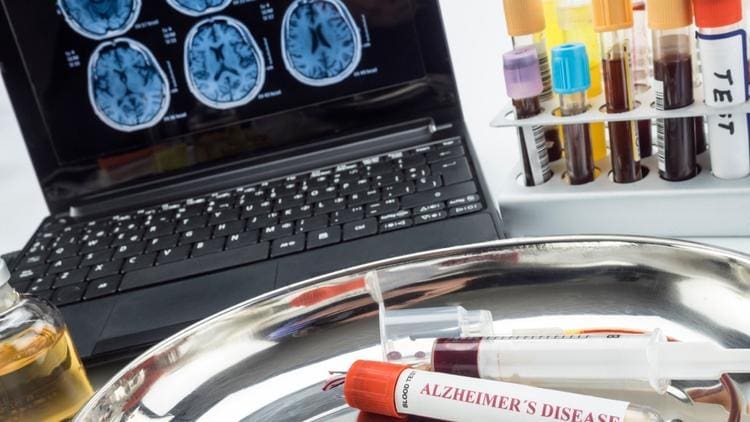 découvrez le lien entre les protéines, la maladie d'alzheimer et le cancer : études récentes, mécanismes biologiques et implications pour la prévention et le traitement de ces maladies.
