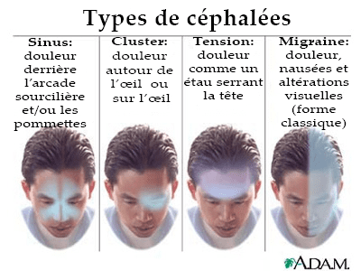 découvrez les principales causes de la douleur au cou côté gauche, ses symptômes et les solutions pour soulager cet inconfort.