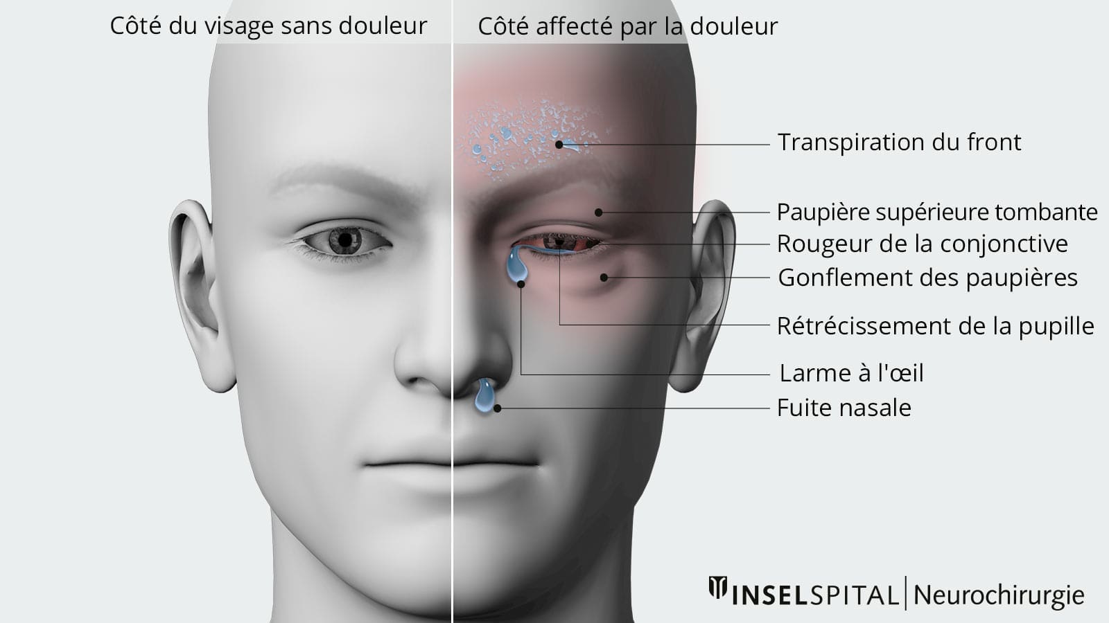 découvrez les causes courantes du mal de tête et leur signification pour mieux comprendre et soulager vos douleurs.
