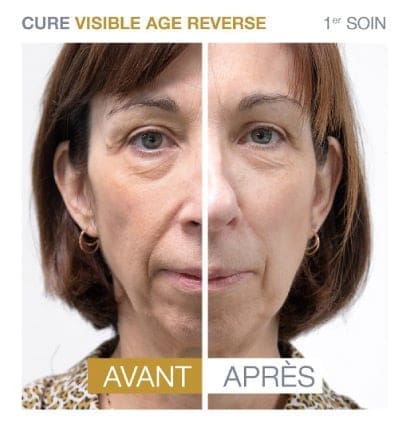 découvrez sofwave, le traitement anti-âge innovant qui offre des résultats visibles dès la première séance pour une peau plus ferme et rajeunie.